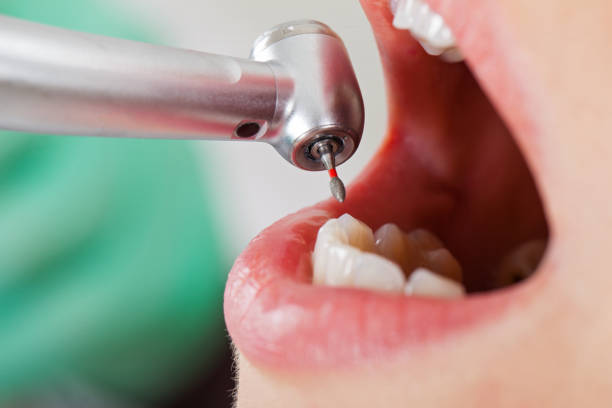 Best Emergency Dental Services for Seniors in Eatontown, NJ
